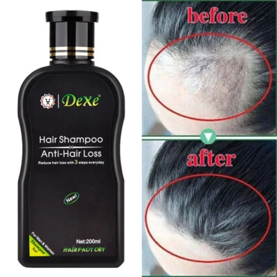 DEXE Fast Hair Growth Shampoo For Women Men Anti Hair Loss Treatment Care Thickening
