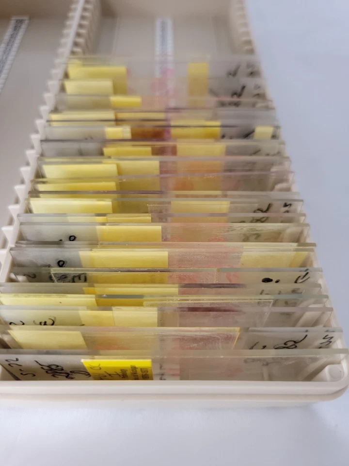 1976-77 Pathology Neoplasm University of Michigan Microscope Slides - Image 4 of 4