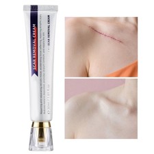 Scar Removal Cream   Fades Scars  Repairs Skin Soothing Repair Lotion 30ml 