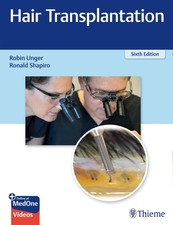 Hair Transplantation Robin Unger