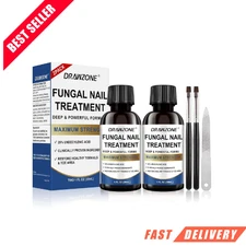 Tratamiento extrafuerte para hongos en las uñas de los pies con 25 % de ácido