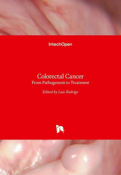 Luis Rodrigo | Colorectal Cancer | Buch | Englisch (2016) | 440 S. | Intechopen-image