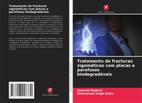 Tratamento De Fracturas ZigomáTicas Com Placas E Parafusos BiodegradáVeis Buch