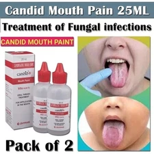 CANDID MOUTH PAINT FOR ORAL THRUSH TREATMENT 25 ML EACH USA PACK OF 2
