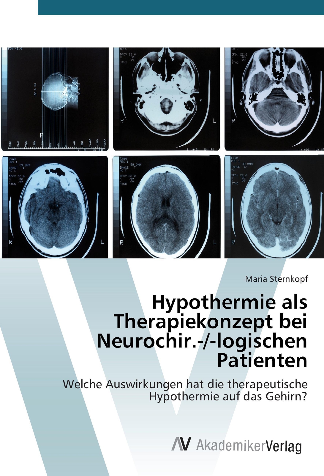 Hypothermie Als Therapiekonzept Bei Neurochir.-/-logischen Patienten