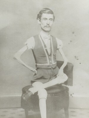 VINTAGE - PHOTO - CIRCUS SHOW - HORROR - FREAK