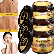 Bee Venom Skin Restoration Cream, Professional Bee Venom Skin Treatment Cream US
