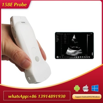 158E Wireless Ultrasound Color Doppler 3 in 1 Convex Linear Phased Array Probe