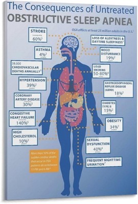 Obstructive Sleep Apnea Health Risks Medical Infographic Wall Art Poster Chart