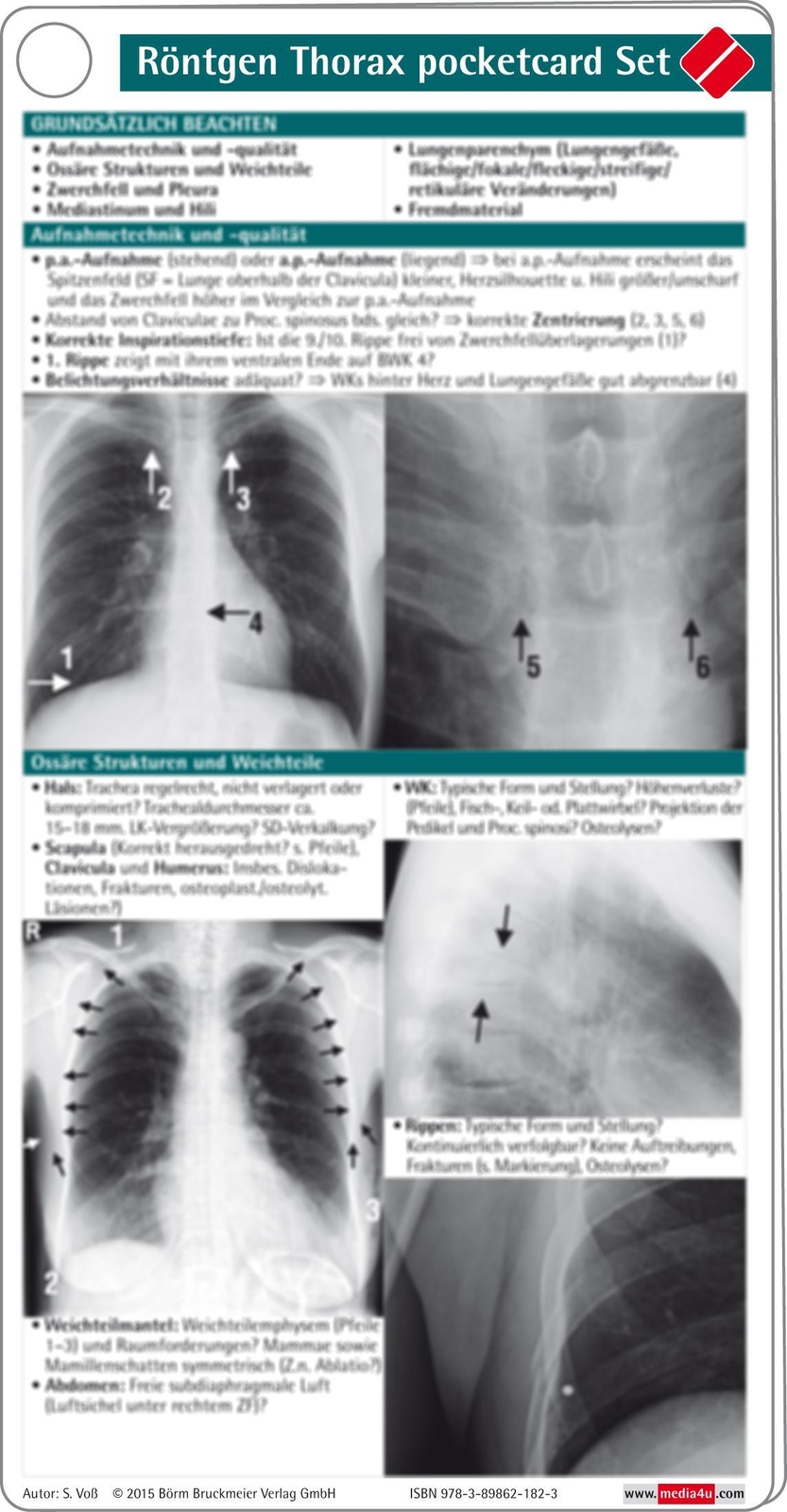 Thumbnail - Röntgen Thorax Pocketcard Set | S. Voß | Buch | Pocketcards | 4 S. |