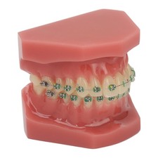 Orthodontic Bracket Model Dental Orthodontics Model Safe Professional Teaching