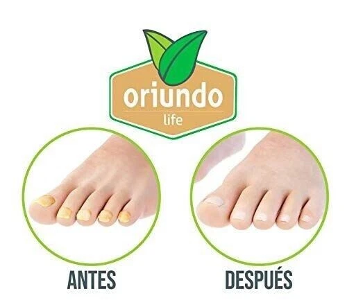ORIUNDO Natural Life / Nail Fungus Away (Quita Hongos para Uñas) 0.5 OZ Nuevo EE. UU. Foto 2 de 4