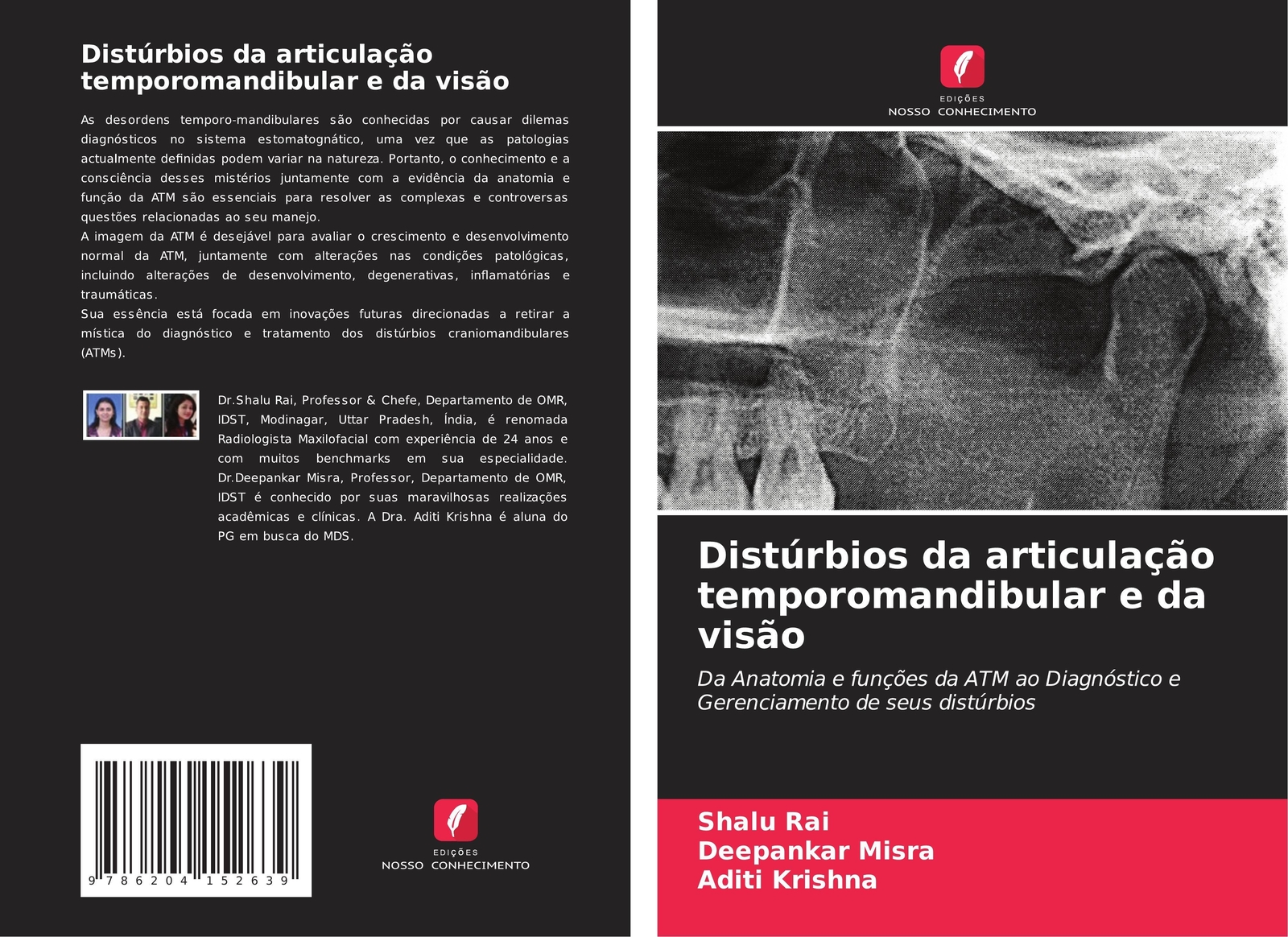 Thumbnail - Distúrbios Da Articulação Temporomandibular E Da Visão | Shalu Rai (u.