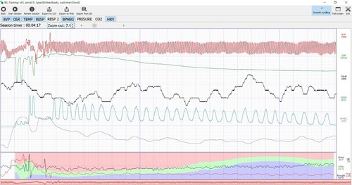 Biofeedback 4 sensores 5 señales increíble software Hecho en Israel - Imagen 15 de 17