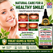 STOP GUM DISEASE FAST PURE HERBAL OIL REMEDY ORAL & DENTAL PAINS 100 ML