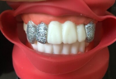 DIY GRILLZ Vampir Veneers Eckzahn/Augenzahn, Reißzähne, Halloween, Cosplay, Anime