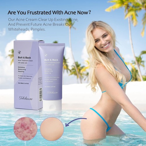 Trattamento acne schiena, trattamento di pulizia acne butt, rimozione acne cosce e torace US - Foto 2 di 7