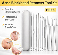 Blackhead Remover Tool Kit Acne Pimple Popper Comedone Extractor Stainless Steel