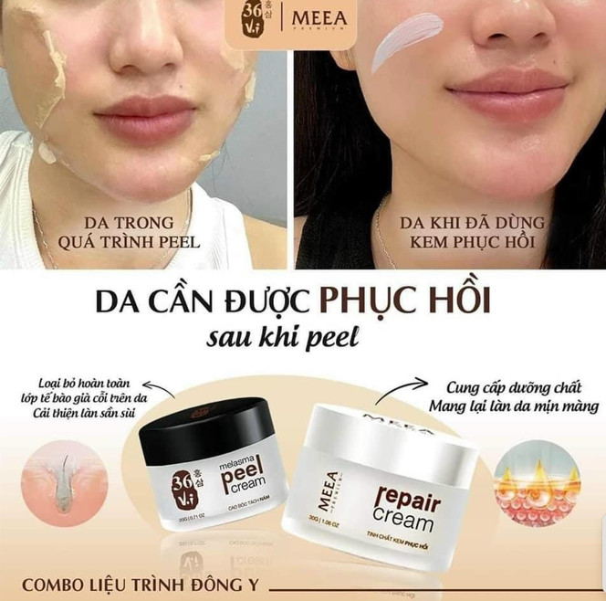 Combo MEEA Melasma Peeling Cream + Premium Repair Cream Tri nam, chong lao hoa