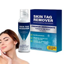 60ML Mole Remover Spots Removal Spray Skin Tags Remover Non-Invasive Beauty