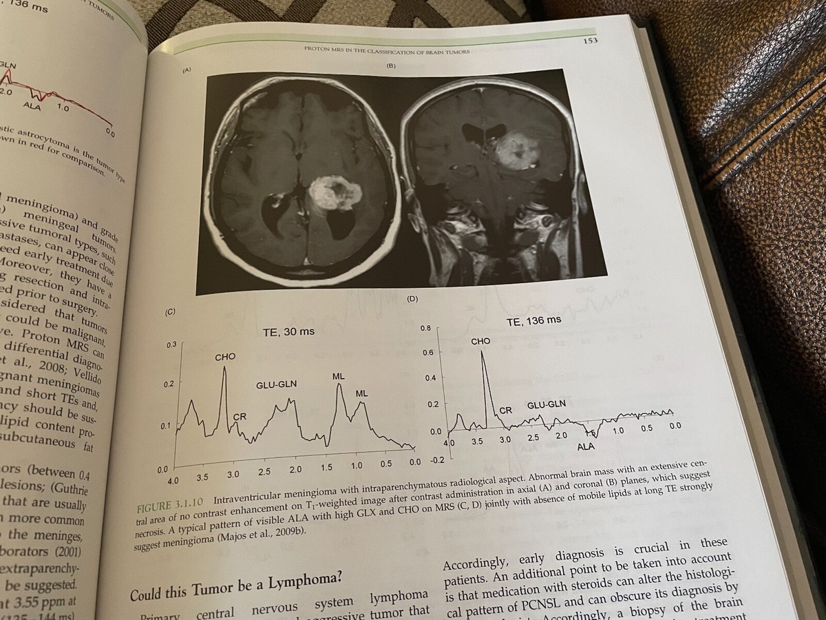 Magnetic Resonance Spectroscopy: Tools for Neuroscience Research and Emerging Clinical Applications [ハードカバー] Stagg PhD， Charlotte; Rothman PhD， Douglas L. Magnetic Resonance Spectroscopy : Tools for Neuroscience