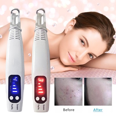 Picosecond Laser Stift Mole Narben Tattoo Entfernung Stift Blau Licht EU Steckn0