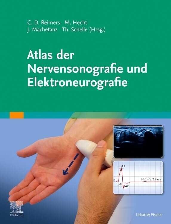 Thumbnail - Atlas Der Nervensonografie Und Elektroneurografie | 2022 | Deutsch