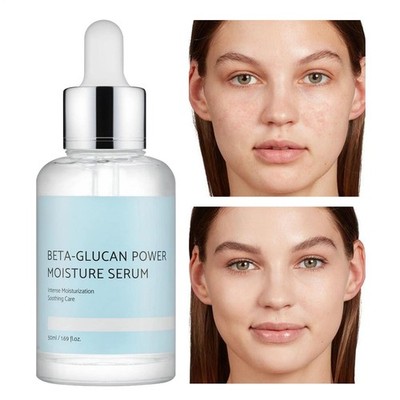 IUNIK Beta-Glucan Power Moisture Intense Serum Beruhigende Pflege Vegan 1,69 Unz