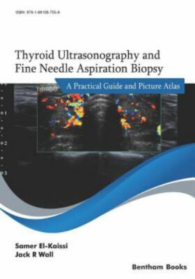 Thyroid Ultrasonography and Fine Needle Aspiration Biopsy: A Practical Guide ...