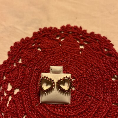 Aretes 