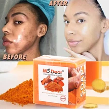 1-3X Turmeric Soap Bar for Face&Body-Tumeric Soap, Acne, Dark Spots, Smooth Skin