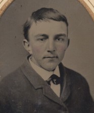 PORTRAIT OF YOUNG MAN W/ THINNING HAIR 