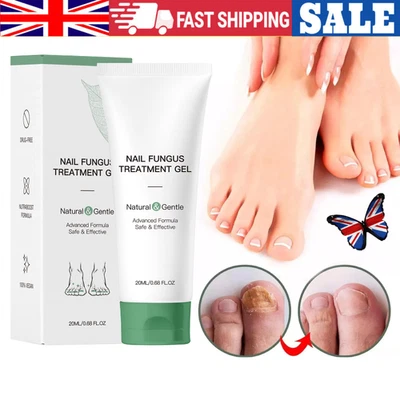 Gel Tratamiento Hongos Uñas Nutraboost 20ML, Gel Fortalecedor Reparación Uñas Natural