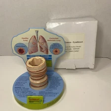 Symbicort Asthma Lung Airway Model Pharma Doctor Display AstraZeneca 2008
