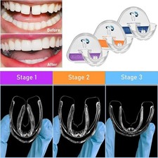 Dental Orthodontic Teeth Straightening Retainer Tooth Corrector Alignment Braces