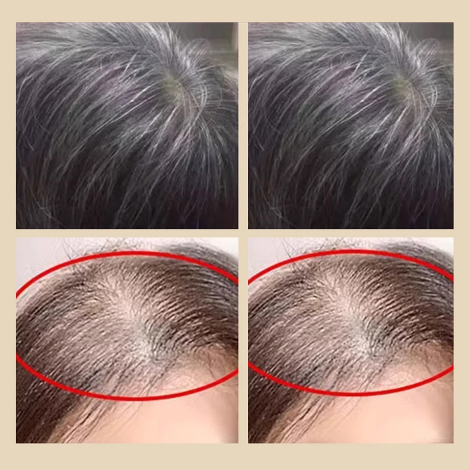 Ayurveda Saffron & Cinnamon Root Strenghtening Scalp Tonic Hair Growth Spray - Image 4 of 4