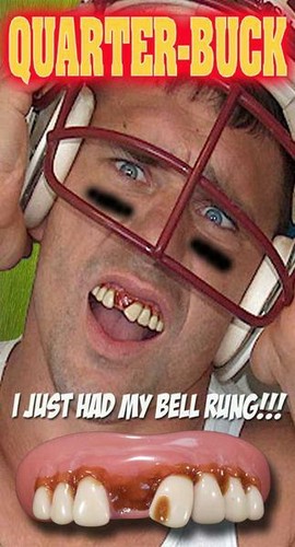 Billy Bob Teeth Original Classic & Asso Crazy Redneck Costume Prosthetic Teeth - Picture 16 of 22