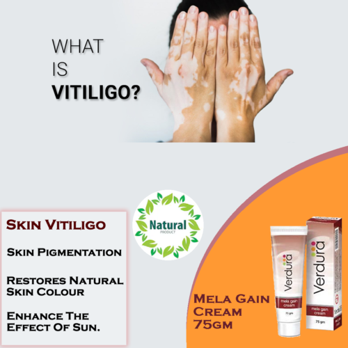 Crema Mela Gain 75 gm - ungüento para tratamiento del vitiligo - Imagen 3 de 14