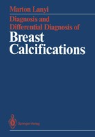Marton Lanyi | Diagnosis And Differential Diagnosis Of Breast Calcifications