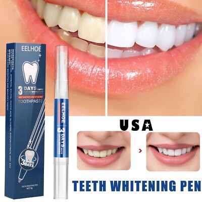 Teeth Whitening Gel Pen Extra Strong Stain Removal White Hygiene Tooth Whitener