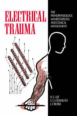 Electrical Trauma The Pathophysiology, Manifestations and Clinical Management