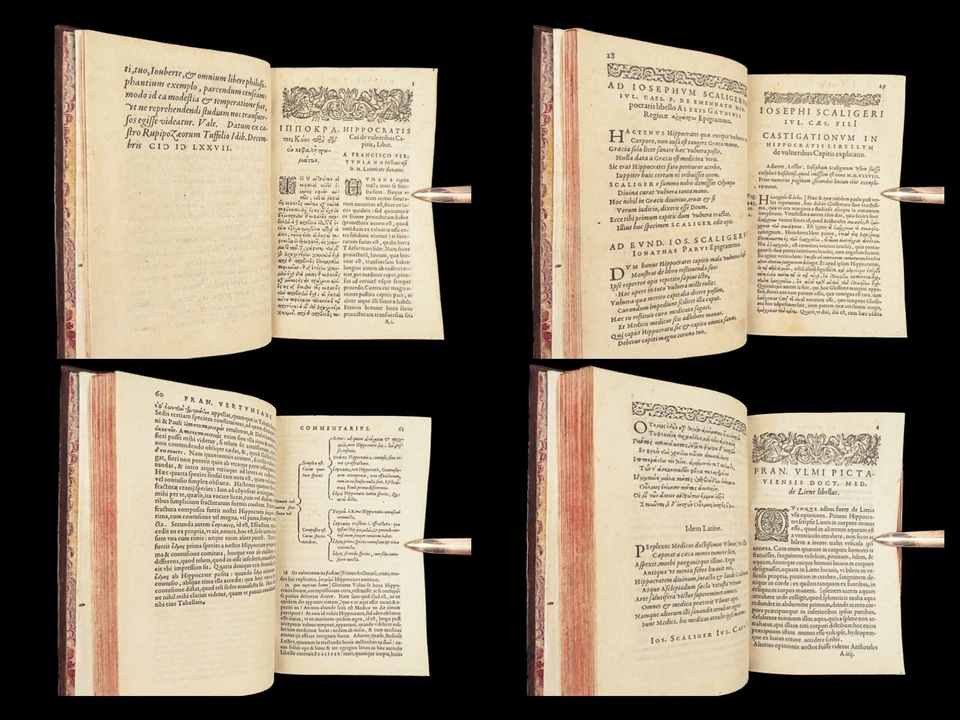 1578 HIPPOCRATES Head Wounds Greek Medicine Surgery Infant Nursing RARE 4in1 - Image 2 of 4