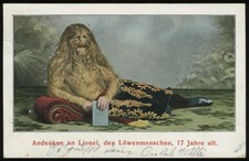 Vintage RPPC Photo of Lion Face Man! Carnival Circus Freak Postcard 1906s