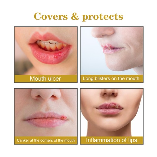 60Pcs Cold Sore Healing Patches Fast Heals Cold Sores Blister Lip Skin Treatment - Picture 3 of 11