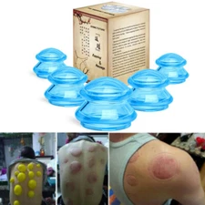 Cupping THERAPY Set Anti Cellulite Remover Full Body Massager massage Cup Sucion