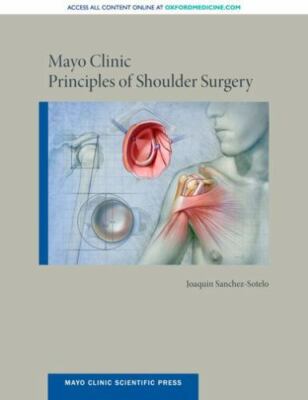 Mayo Clinic Principles of Shoulder Surgery (Mayo Clinic Scientific Press), Sanch