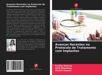 AvançOs Recentes No Protocolo De Tratamento Com Implantes Kanika Sharma