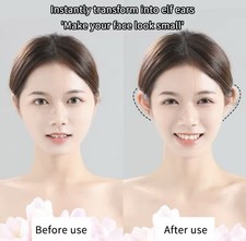 Correttore Estetico Adesivo Per Orecchie a Sventola Invisibile 30 Pezzi