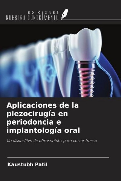 Aplicaciones De La PiezocirugíA En Periodoncia E ImplantologíA Oral Kaustubh Pat-image