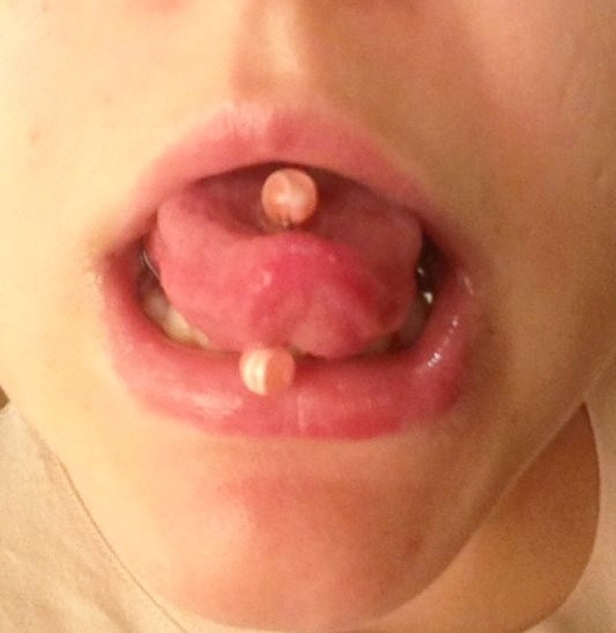 Picture 13 of 22